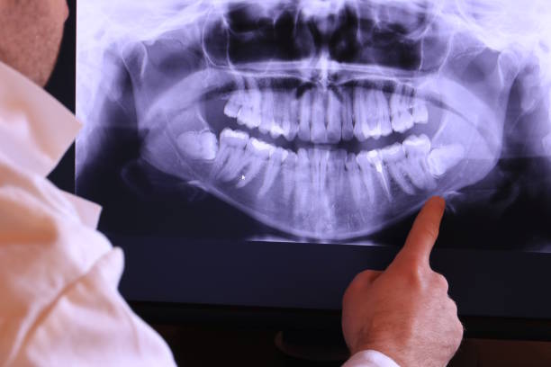 Best Emergency Root Canal Treatment in Glen Carbon, IL